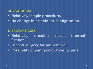 ADVANTAGES: Relatively simple procedure.No change in acetabular configuration.DISADVANTAGES:Relatively unstable needs internal fixation.Second surgery for pin removal.Possibility of joint penetration by pins.