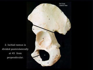2. Ischialramus is divided posterolaterally at 45° from perpendicular.