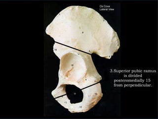 3.Superior pubic ramus is divided posteromedially 15° from perpendicular. 