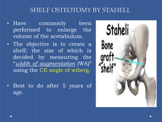 SHELF OSTEOTOMY BY STAHELI.Have commonly been performed to enlarge the volume of the acetabulum.The objective is to create a shelf, the size of which is decided by measuring the “width of augmentation (WA)” using the CE angle of wiberg. Best to do after 5 years of age.