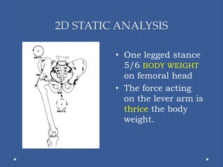 2D STATIC ANALYSISOne legged stance 5/6 BODY WEIGHTon femoral headThe force acting on the lever arm is thrice the body weight.