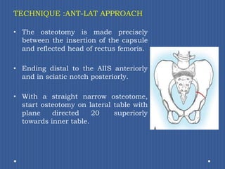 TECHNIQUE :ANT-LAT APPROACHThe osteotomy is made precisely between the insertion of the capsule and reflected head of rectus femoris.Ending distal to the AIIS anteriorly and in sciatic notch posteriorly. With a straight narrow osteotome, start osteotomy on lateral table with plane directed 20° superiorly towards inner table.