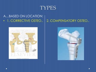 TYPESA…BASED ON LOCATION:1. CORRECTIVE OSTEO..    2. COMPENSATORY OSTEO..