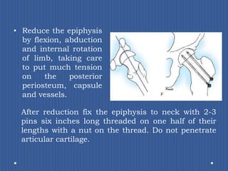 Reduce the epiphysis by flexion, abduction and internal rotation of limb, taking care to put much tension on the posterior periosteum, capsule and vessels. After reduction fix the epiphysis to neck with 2-3 pins six inches long threaded on one half of their lengths with a nut on the thread. Do not penetrate articular cartilage.