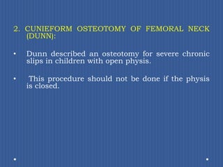 2. CUNIEFORM OSTEOTOMY OF FEMORAL NECK (DUNN): Dunn described an osteotomy for severe chronic slips in children with open physis.This procedure should not be done if the physis is closed. 