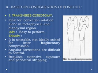 B…BASED ON CONFIGURATION OF BONE CUT :1: TRANSVERSE OSTEOTOMY:Ideal for  correction rotation alone in metaphyseal and diaphysial region. Adv:  Easy to perform.Disadv: It is unstable, not ideally suited for inter fragmentary compression.Angular corrections are difficult to control.Requires extensive exposure and periosteal stripping. 
