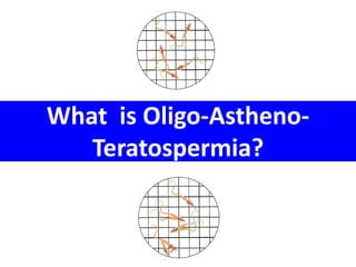 What is Oligo-Astheno- 
Teratospermia? 
 