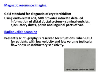 Magnetic resonance imaging 
Gold standard for diagnosis of cryptorchidism 
Using endo-rectal coil, MRI provides intricate detailed 
information of distal ductal system – seminal vesicles, 
ejaculatory ducts, pelvic and inguinal parts of Vas. 
Radionuclide scanning 
Presently scinti-graphy is reserved for situations, when CDU 
for patients with low velocity and low volume testicular 
flow show unsatisfactory sensitivity. 
Hypo – osmotic swelling test (200X) 
 
