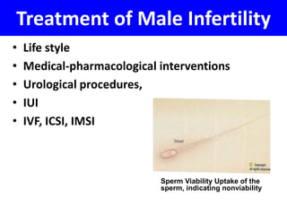 Treatment of Male Infertility 
• Life style 
• Medical-pharmacological interventions 
• Urological procedures, 
• IUI 
• IVF, ICSI, IMSI 
Sperm Viability Uptake of the 
sperm, indicating nonviability 
 