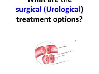 What are the 
surgical (Urological) 
treatment options? 
 