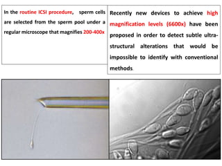 Recently new devices to achieve high 
magnification levels (6600x) have been 
proposed in order to detect subtle ultra-structural 
alterations that would be 
impossible to identify with conventional 
methods. 
In the routine ICSI procedure, sperm cells 
are selected from the sperm pool under a 
regular microscope that magnifies 200-400x 
 