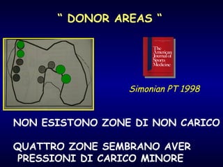 “  DONOR AREAS “ Simonian PT 1998 NON ESISTONO ZONE DI NON CARICO QUATTRO ZONE SEMBRANO AVER PRESSIONI DI CARICO MINORE 