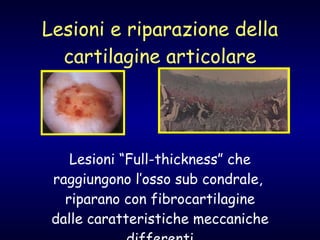 Lesioni e riparazione della cartilagine articolare Lesioni “Full-thickness” che raggiungono l’osso sub condrale,  riparano con fibrocartilagine dalle caratteristiche meccaniche differenti 