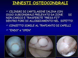 CILINDRI DI CARTILAGINE IALINA CON  OSSO SUBCONDRALE PRELEVATO DA ZONE  DI NON CARICO E TRASFERITE “PRESS-FIT”  DENTRO FORI DI ALLOGGIAMENTO NEL  DIFETTO CONCETTO SIMILE AL TRAPIANTO DI CAPELLI “ ENDO” e “OPEN” INNESTI OSTEOCONDRALI 