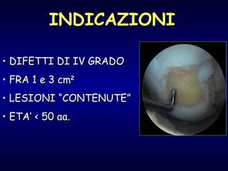 INDICAZIONI DIFETTI DI IV GRADO FRA 1 e 3 cm 2 LESIONI “CONTENUTE” ETA’ < 50 aa. 