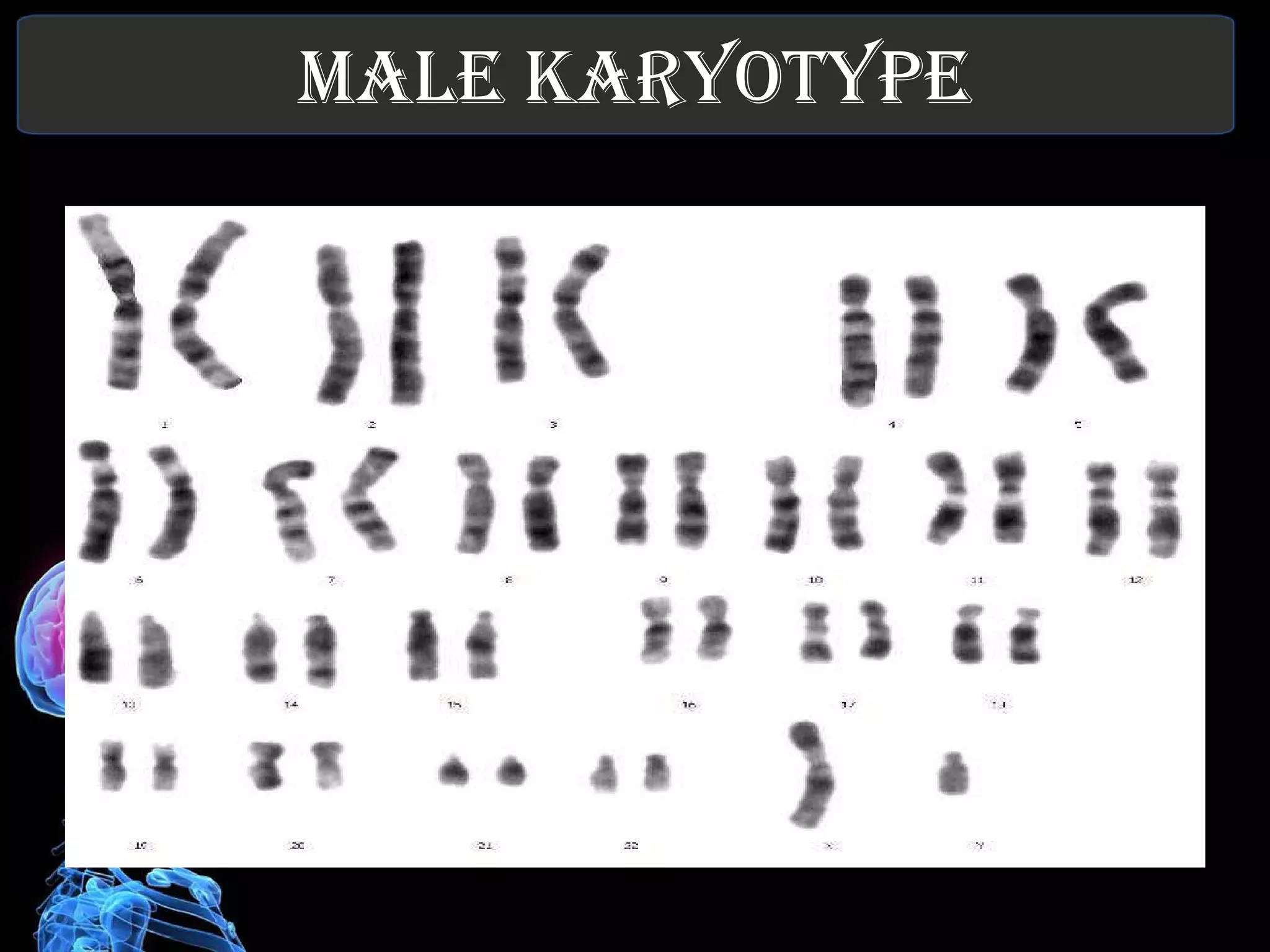 MALE KARYOTYPE 