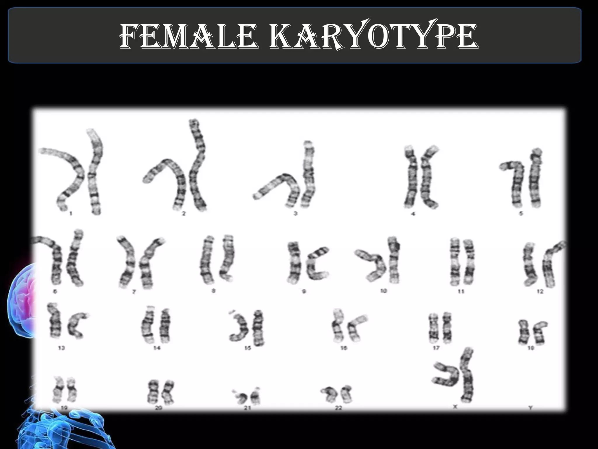 FEMALE KARYOTYPE 