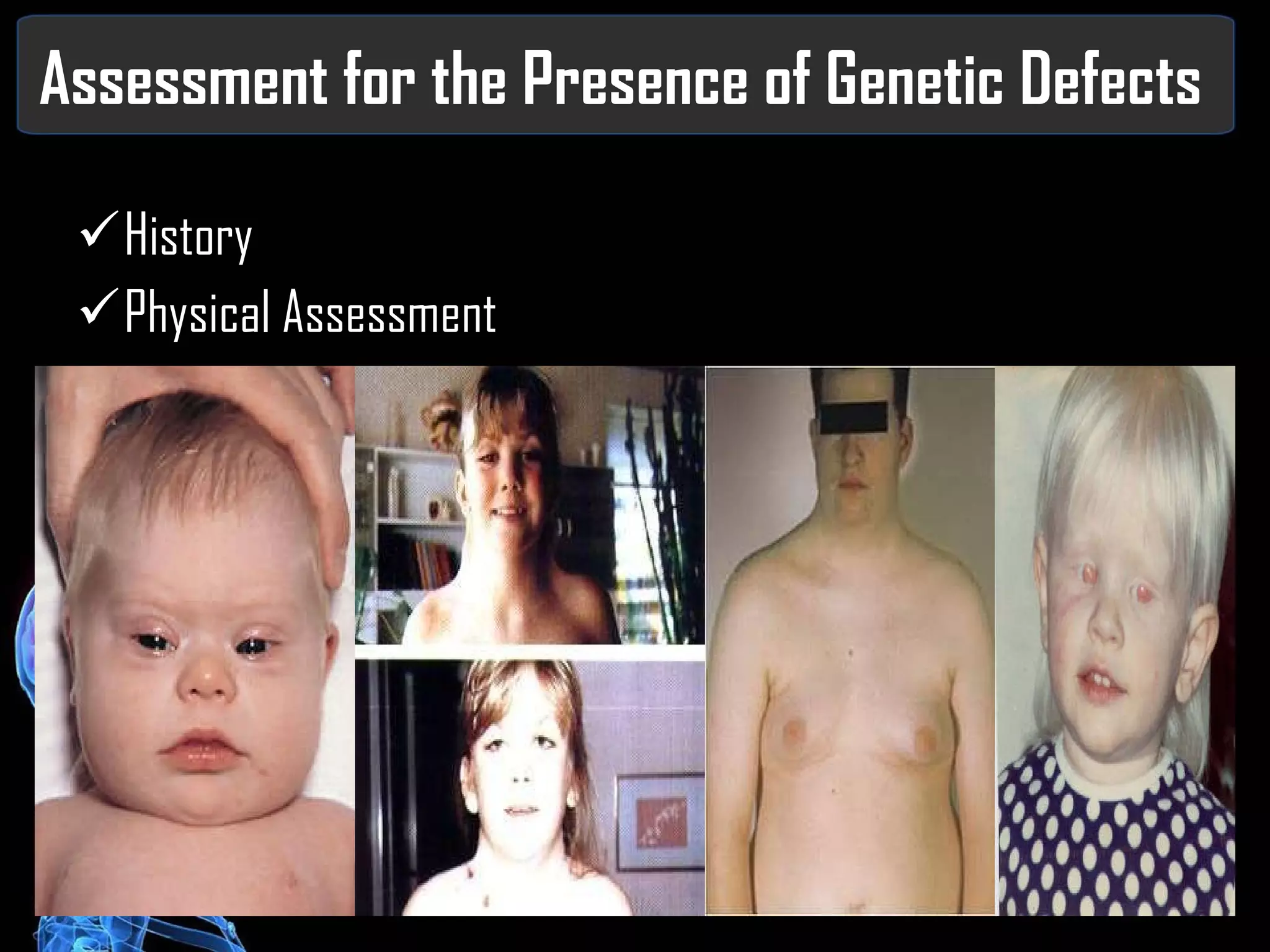 Assessment for the Presence of Genetic Defects History Physical Assessment 
