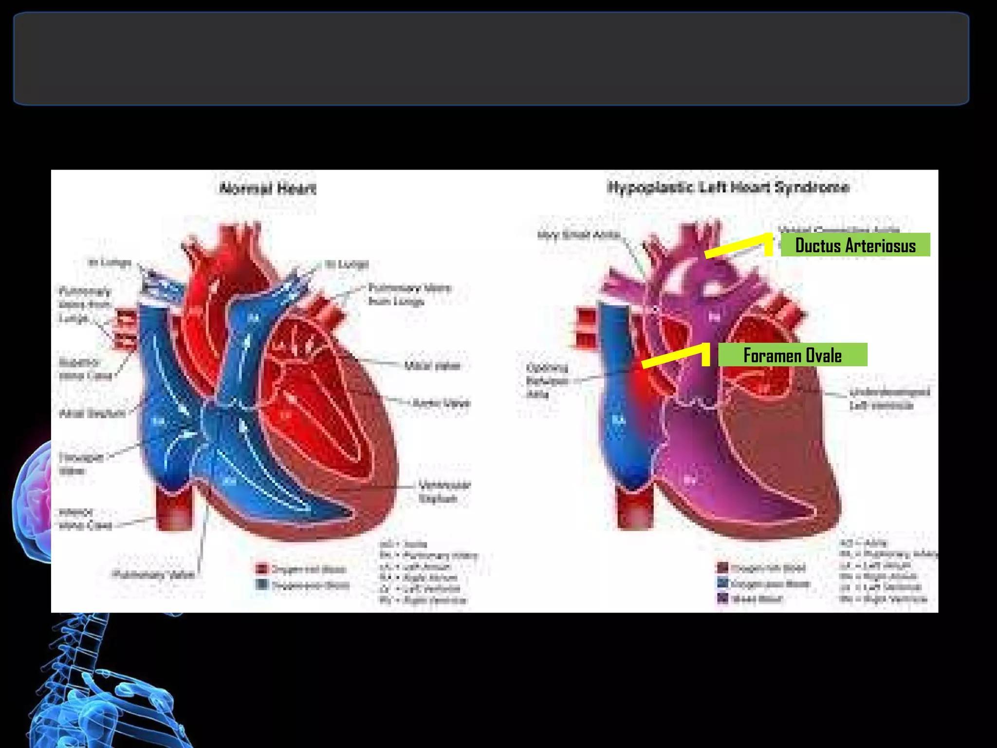 Ductus Arteriosus Foramen Ovale 