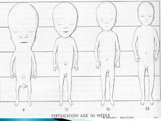 By Alemyehu T March 22-2014 114 
 