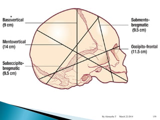 By Alemyehu T March 22-2014 159 
 
