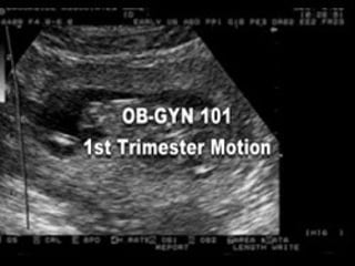 By Alemyehu T March 22-2014 66 
 