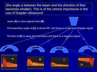(the angle q between the beam and the direction of flow 
becomes smaller). This is of the utmost importance in the 
use of...