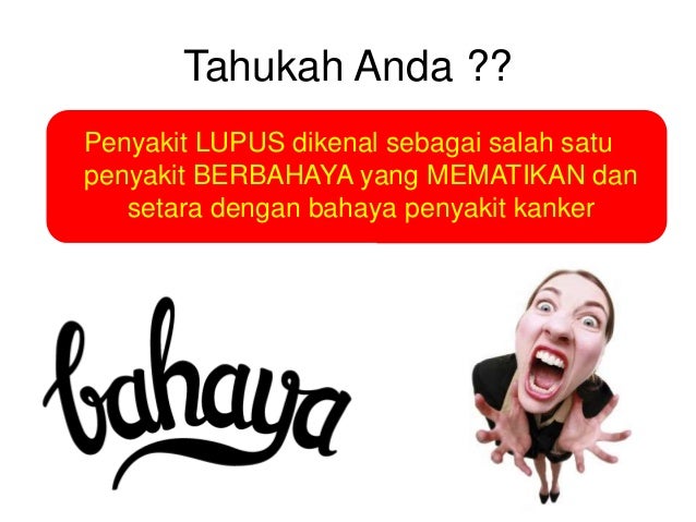 Nasa Obat Lupus Nasa Obat Lupus