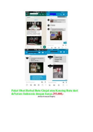 Paket Obat Herbal Batu Ginjal atau Kencing Batu dari
deNature Indonesia dengan harga 295.000,-
(Belum Termasuk Ongkir)
 