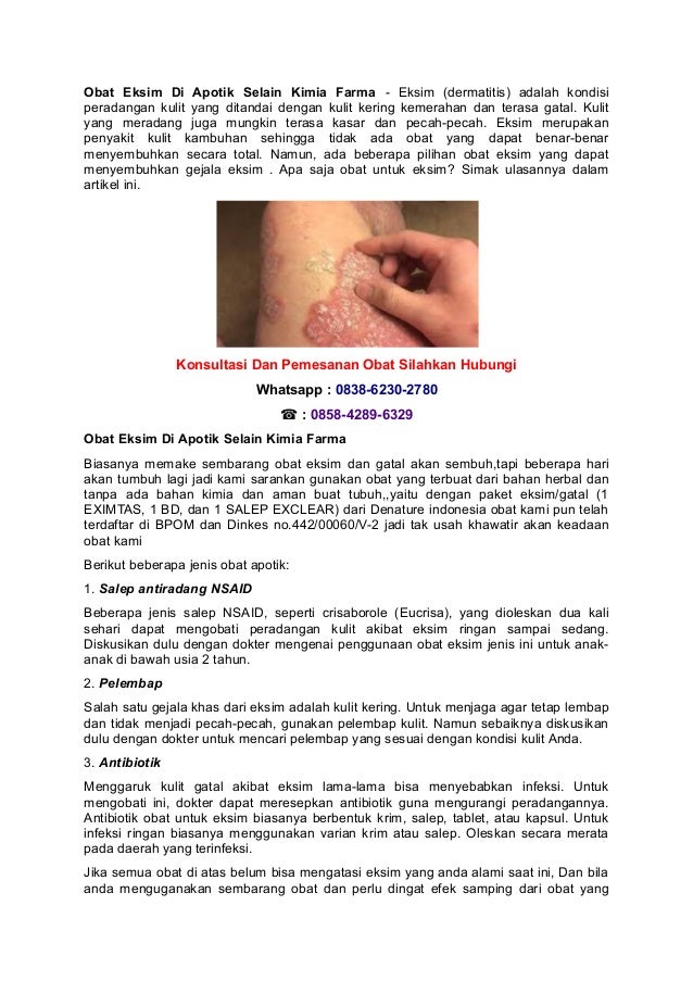 Obat eksim di apotik selain kimia farma