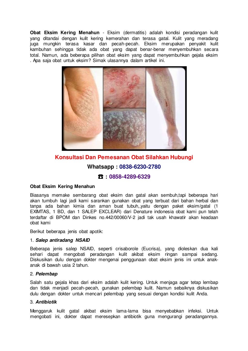 Obat eksim kering menahun