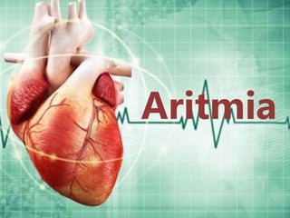 Aritmia
 
