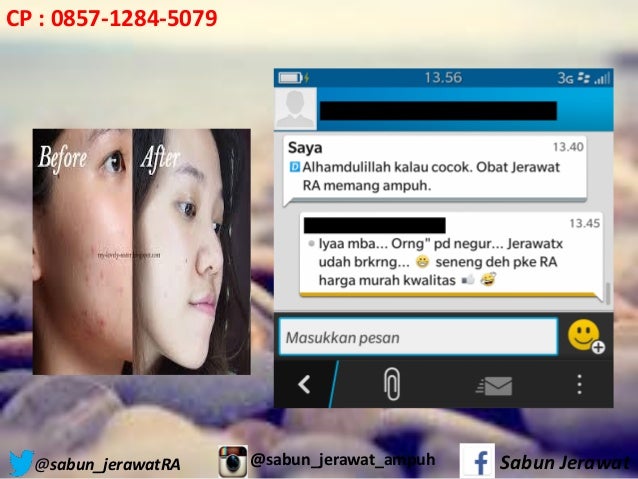 085 712 845 079, Obat penghilang bekas jerawat dengan  