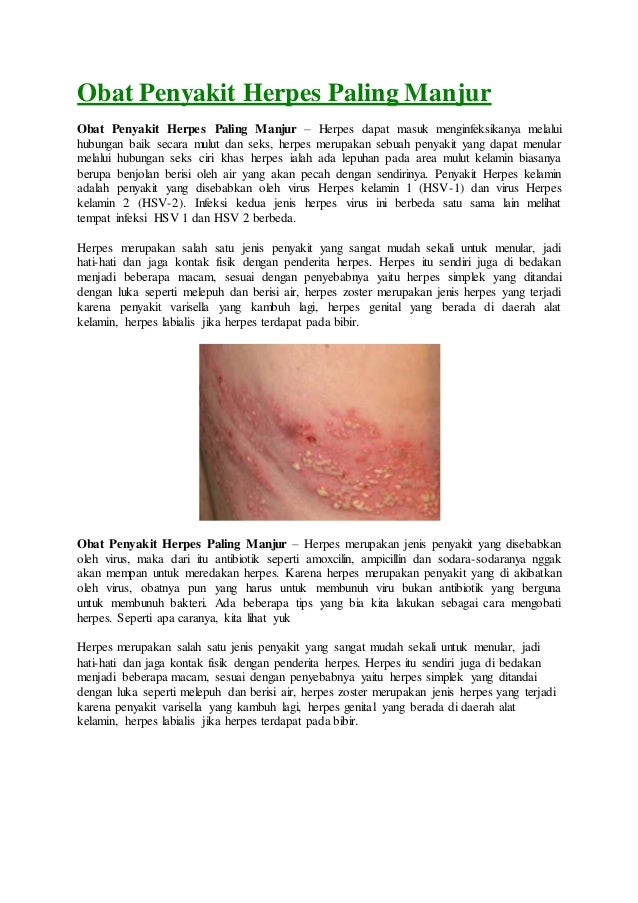 Obat Penyakit Herpes Paling Manjur