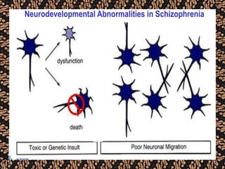 Neurodevelopmental Abnormalities in Schizophrenia
 