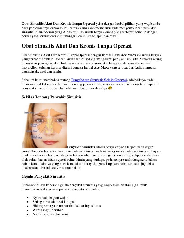 Obat Sinusitis Akut Dan Kronis Tanpa Operasi