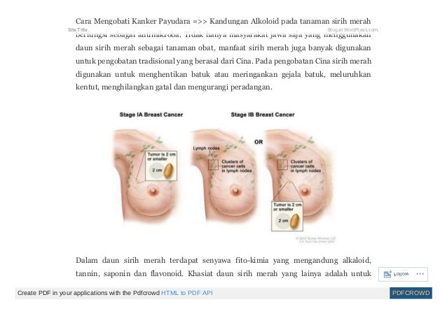 Foto Kanker Payudara Stadium Akhir