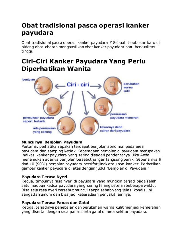 Obat Tradisional Pasca Operasi Kanker Payudara
