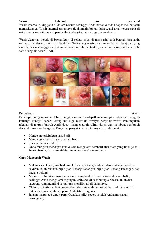 Diabetes Hamil Ibu Aman Obat Untuk Diabetes Hamil Ibu Aman Obat Untuk