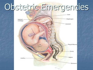 OB emergencies.ppt