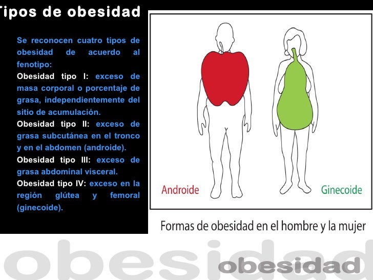 Obesidad Obesidad