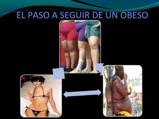 EL PASO A SEGUIR DE UN OBESO