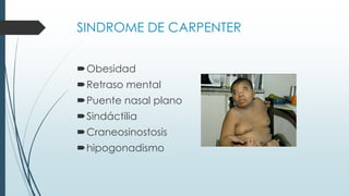 SINDROME DE CARPENTER
Obesidad
Retraso mental
Puente nasal plano
Sindáctilia
Craneosinostosis
hipogonadismo
 
