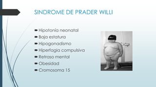 SINDROME DE PRADER WILLI
Hipotonía neonatal
Baja estatura
Hipogonadismo
Hiperfagia compulsiva
Retraso mental
Obesidad
Cromosoma 15
 