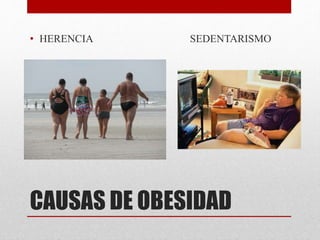 • HERENCIA SEDENTARISMO 
CAUSAS DE OBESIDAD 
 