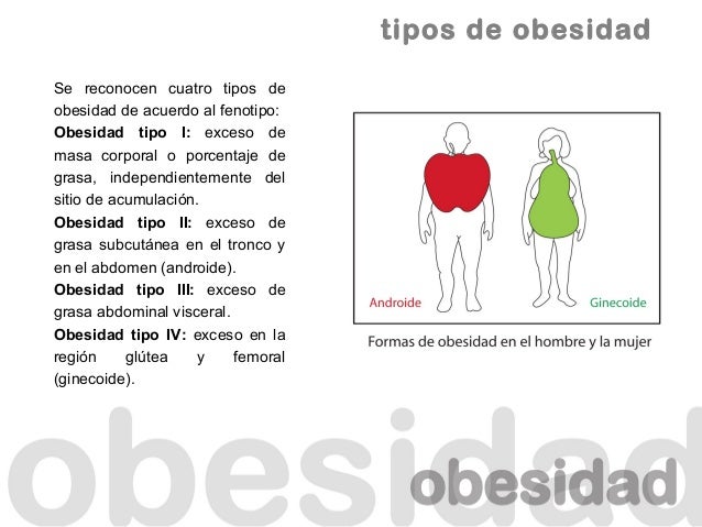 Obesidad Obesidad
