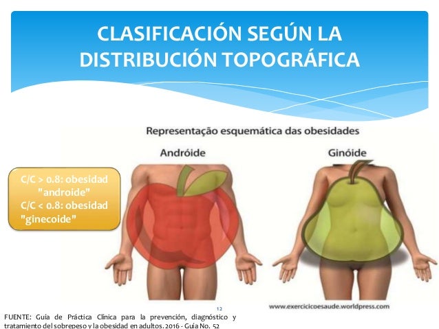 Obesidad Obesidad