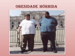 Obesidade