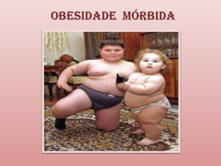 Obesidade