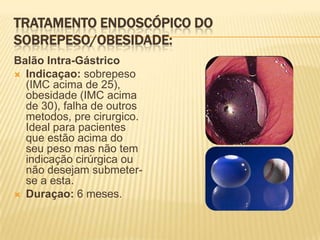 Tratamento Endoscópico do Sobrepeso/Obesidade:Balão Intra-GástricoIndicaçao: sobrepeso (IMC acima de 25), obesidade (IMC acima de 30), falha de outros metodos, pre cirurgico. Ideal para pacientes que estão acima do seu peso mas não tem indicação cirúrgica ou não desejam submeter-se a esta.Duraçao: 6 meses.